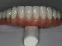 Konig Center for Cosmetic & Comprehensive Dentistry smile photos